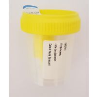 Flacon 60ml en polypropylène pour ECBU avec prise pour tube sous vide stérile avec étiquette
